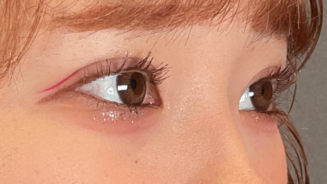 手术前的状态 其一