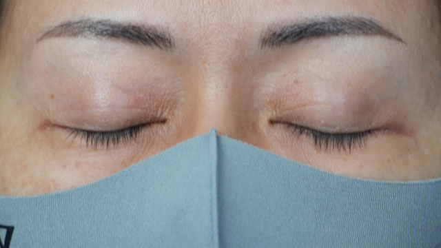 Postoperative Condition Part 1