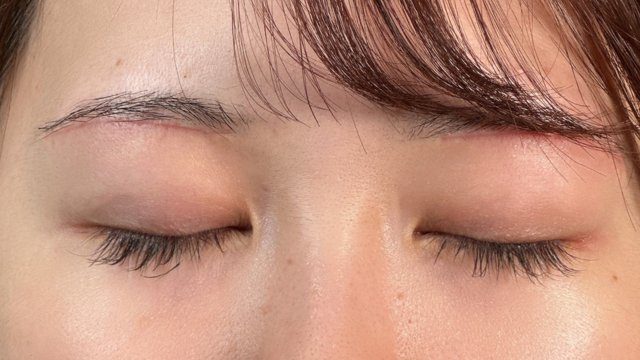 Postoperative Condition Part 1