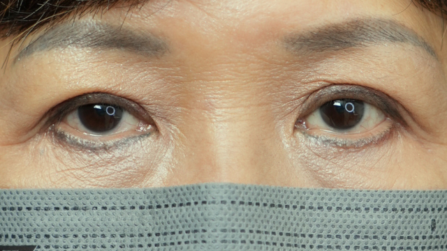 手术前的状态 其一