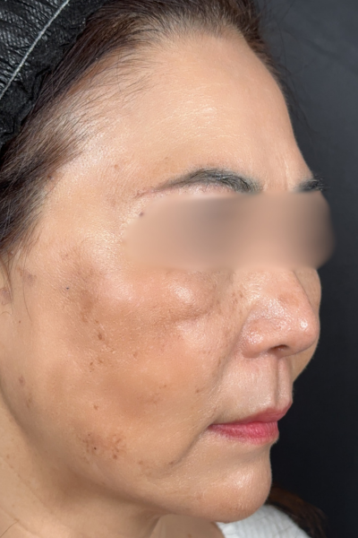 手術前の状態 その1