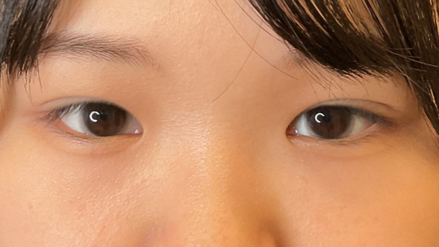 Postoperative Condition Part 1