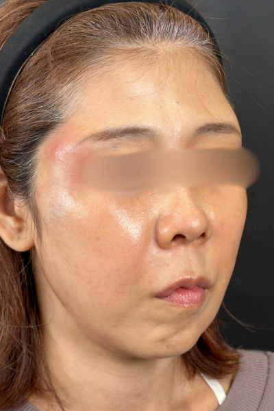 手術前の状態 その1