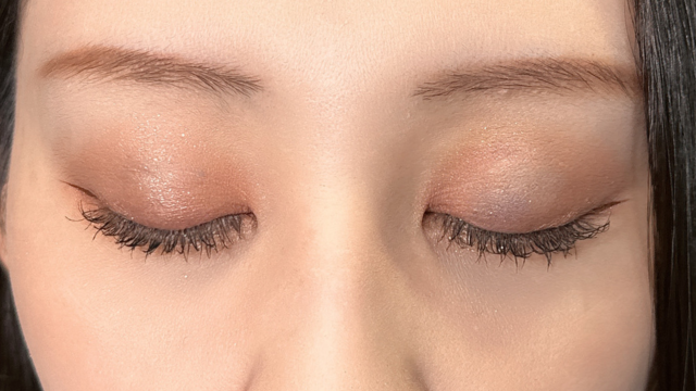 手术前的状态 其一