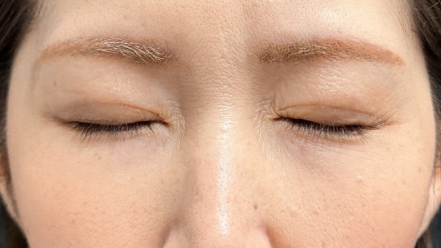 Postoperative Condition Part 1