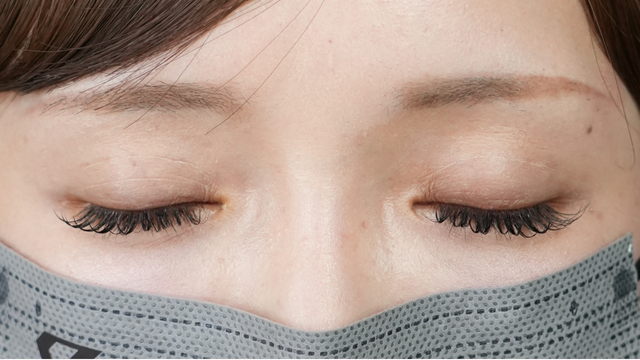 Postoperative Condition Part 1