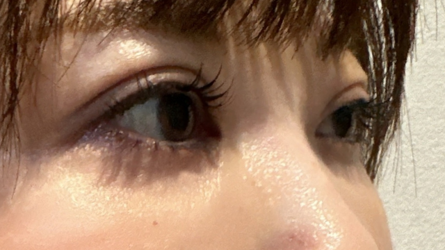 手术前的状态 其一