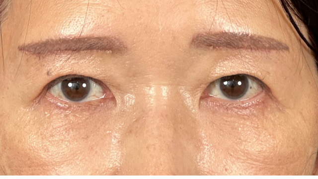 手術前の状態 その1