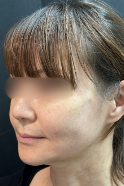 手術前の状態 その1