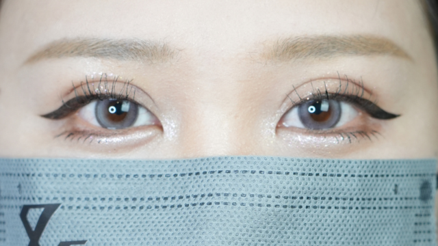 手術前の状態 その1