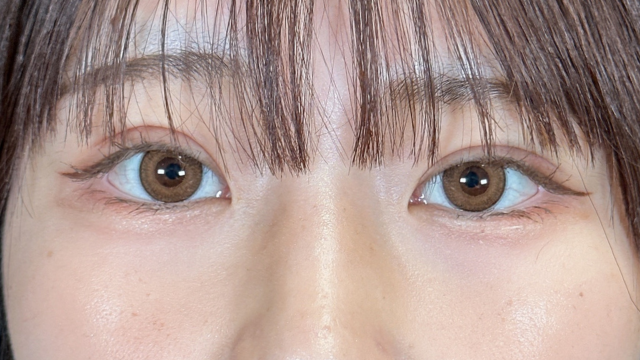 手術前の状態 その1