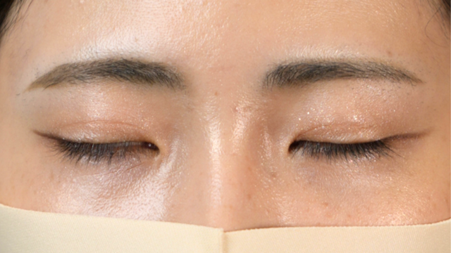 Postoperative Condition Part 1