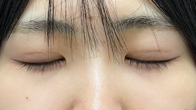 Postoperative Condition Part 1