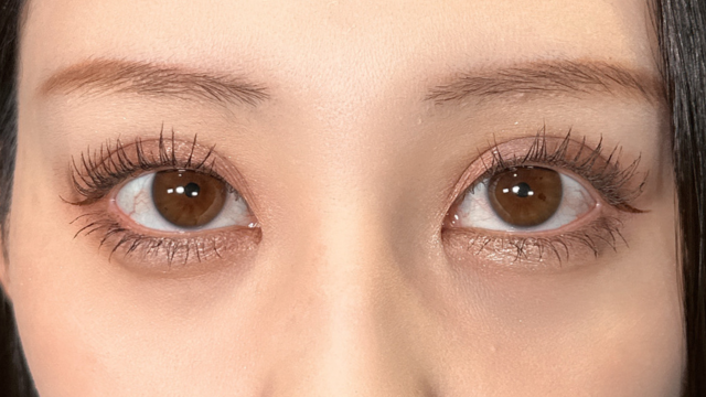 手术前的状态 其一