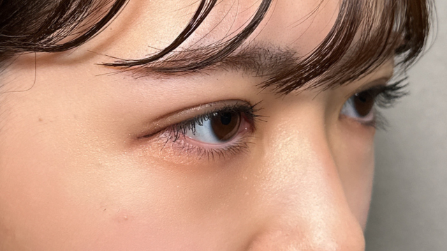 手术前的状态 其一