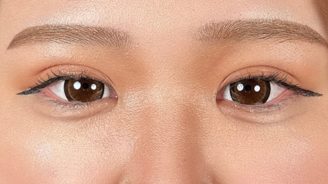 手术前的状态 其一