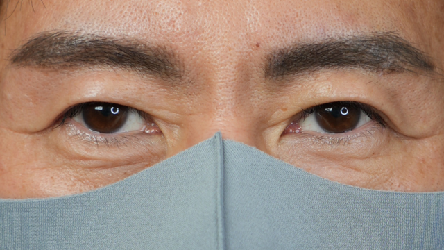 手术前的状态 其一