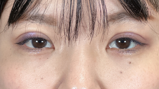 手术前的状态 其一