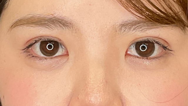 手术前的状态 其一