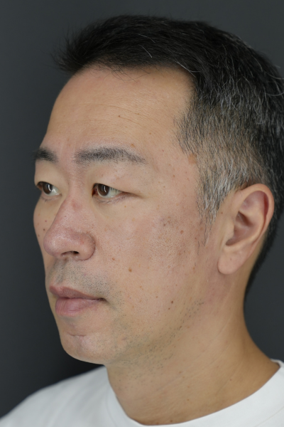 手術前の状態 その1