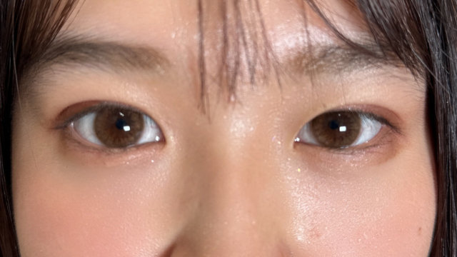 手术前的状态 其一