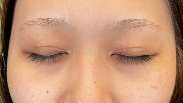 手术前的状态 其一