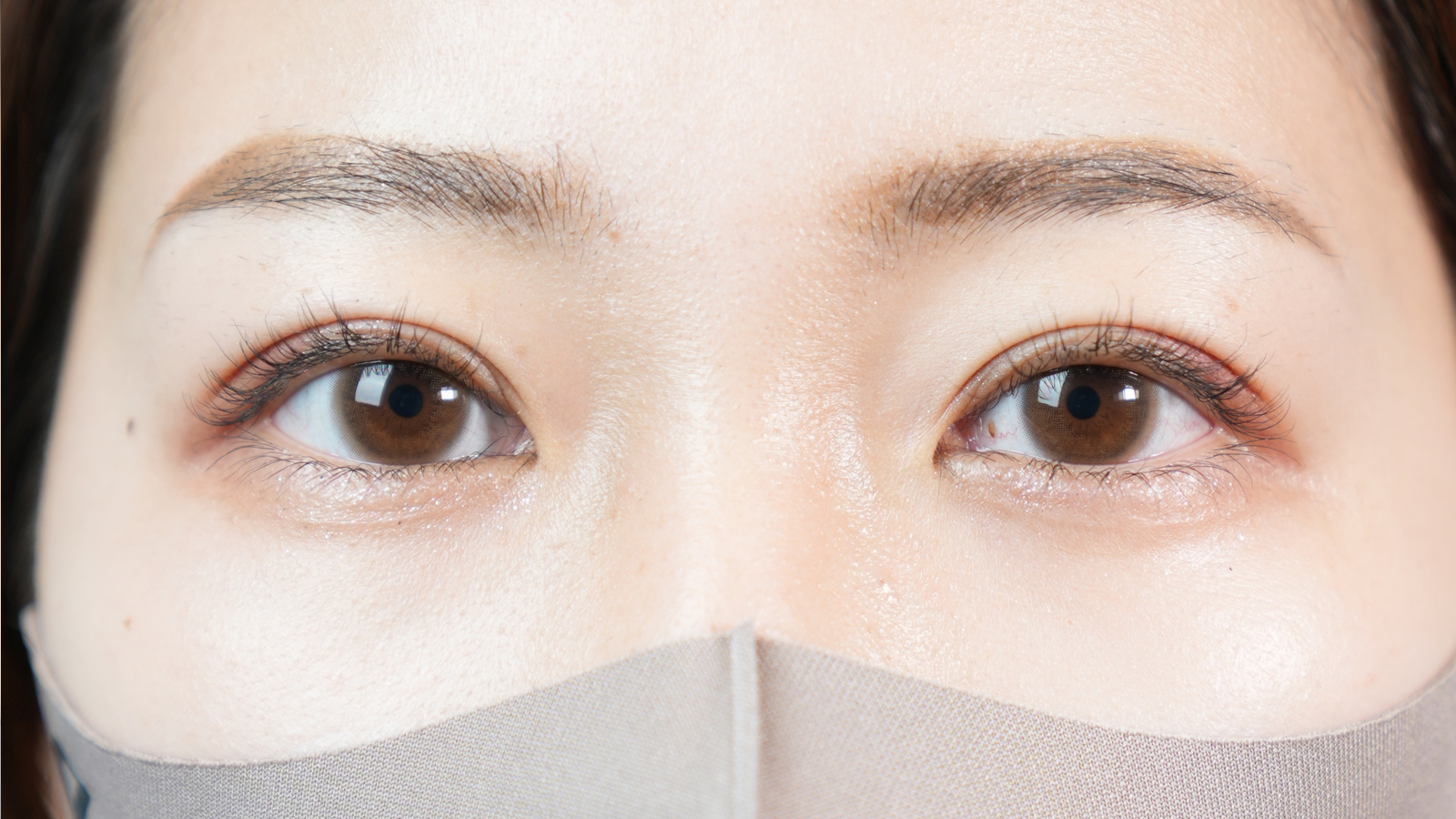 手術前の状態 その1