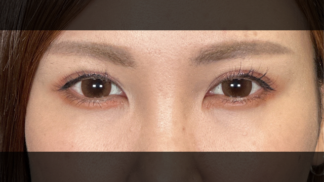 Postoperative Condition Part 1