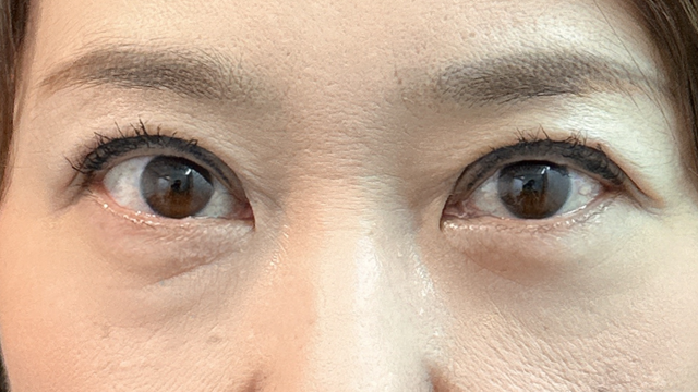 Postoperative Condition Part 1