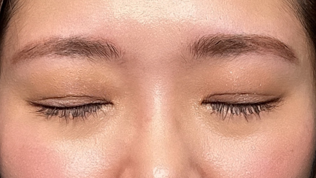 手术前的状态 其一