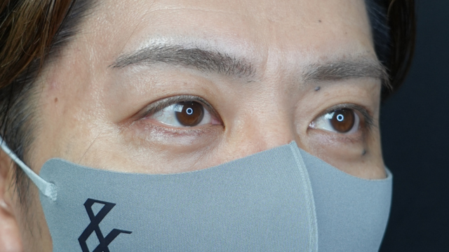 手術前の状態 その1