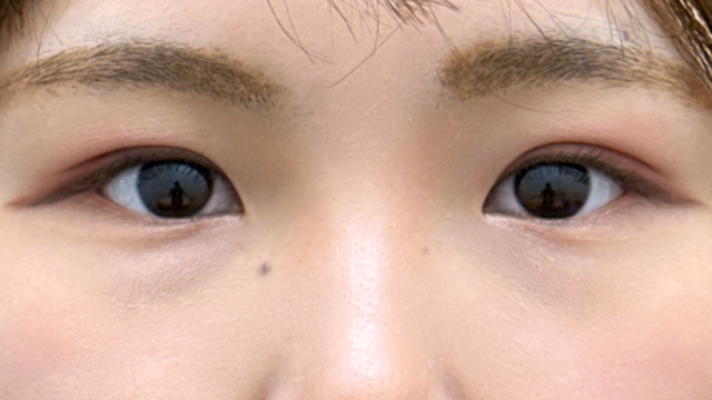 Postoperative Condition Part 1