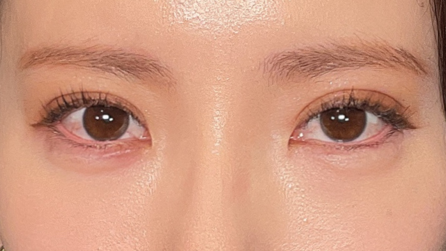 手术前的状态 其一