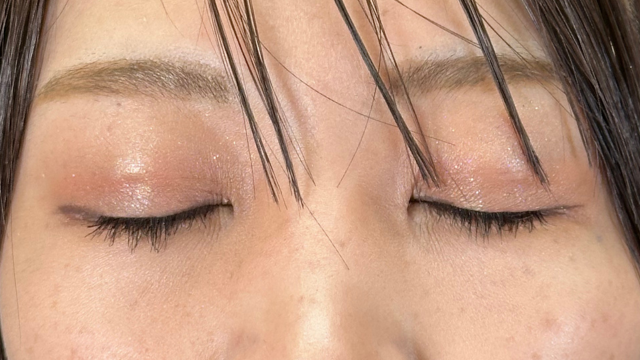 手术前的状态 其一