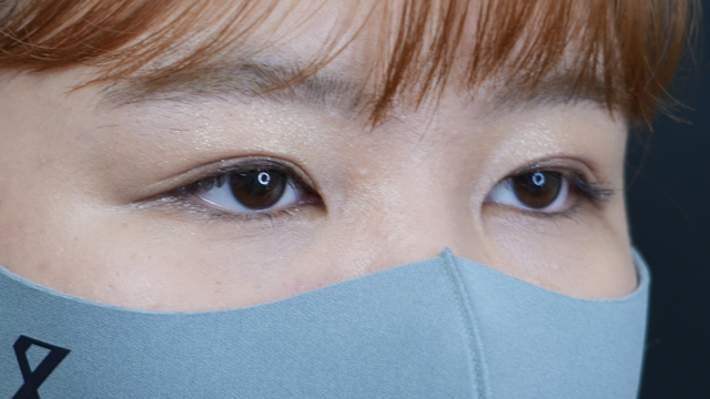 手术前的状态 其一