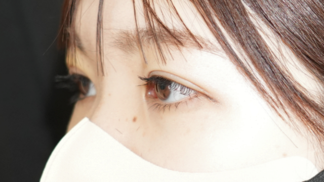 手術前の状態 その1