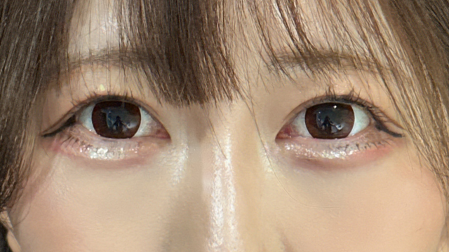 手术前的状态 其一