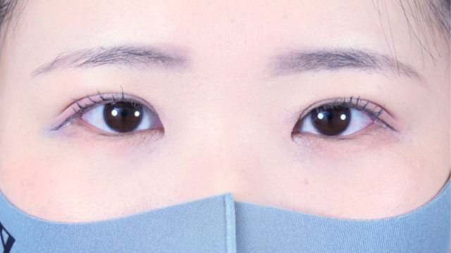 Postoperative Condition Part 1