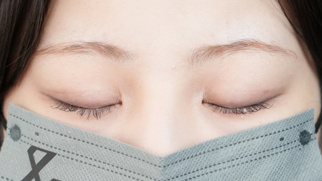 手術前の状態 その1