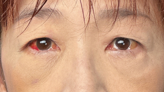 手术前的状态 其一