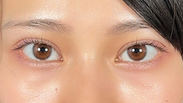 手术前的状态 其一