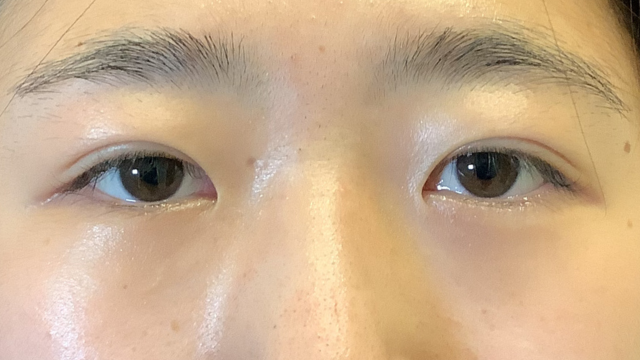 Postoperative Condition Part 1