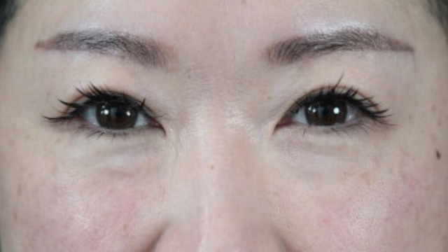 Postoperative Condition Part 1