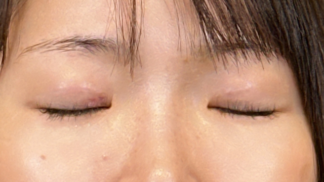 手术前的状态 其一