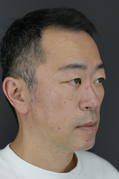 手術前の状態 その1