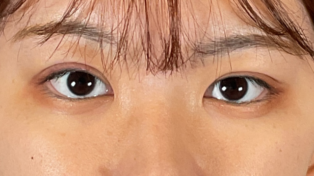 手术前的状态 其一