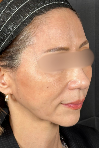 手術前の状態 その1