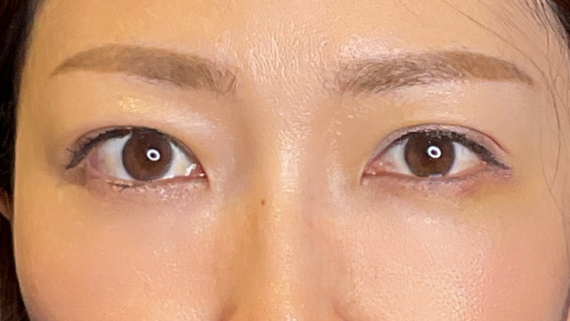 手术前的状态 其一