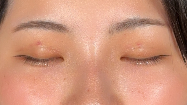 手术前的状态 其一