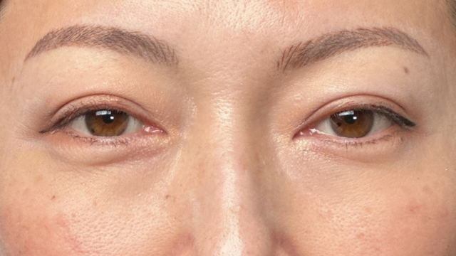 手术前的状态 其一